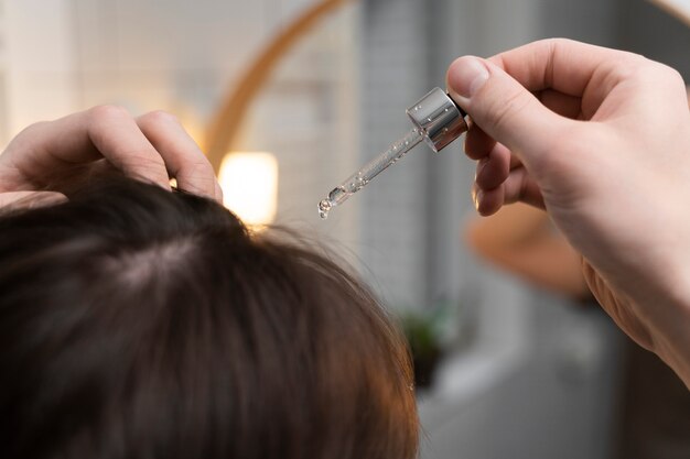 Young man applying anti dandruff product