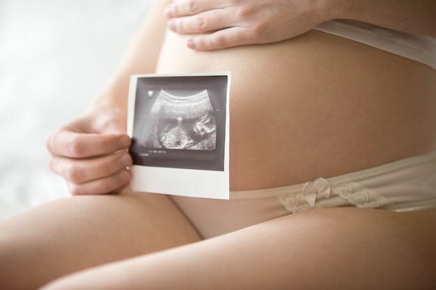 Young pregnant woman showing ultrasonic image of her baby