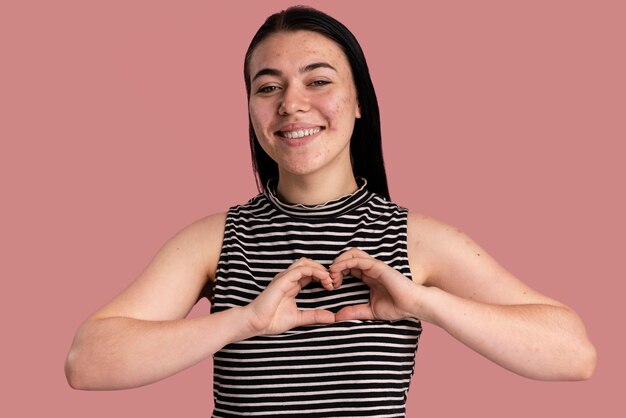 Young woman being confident with her acne