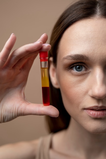 Young woman holding prp vial