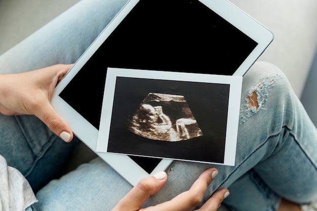 Free Photo young woman with ecography and tablet