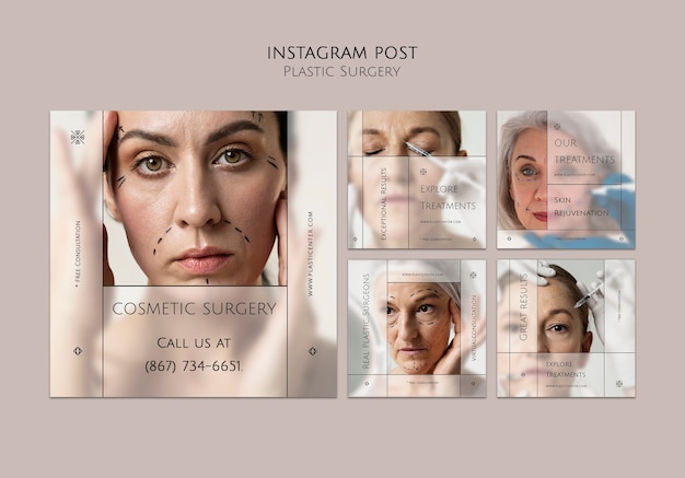 Plastic surgery instagram posts template