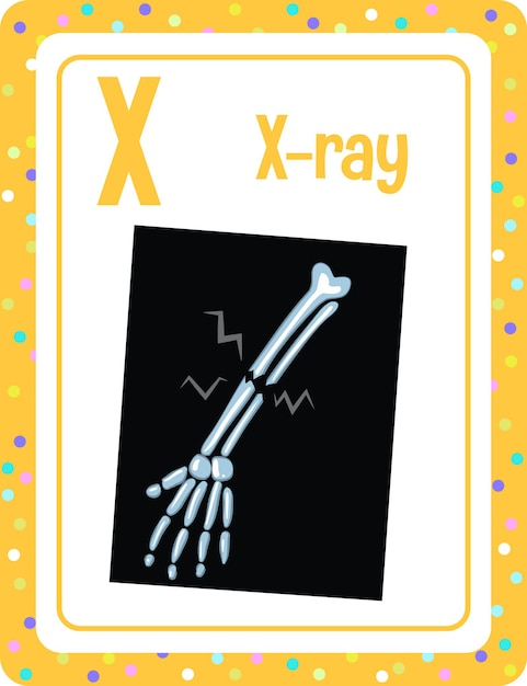 Alphabet flashcard with letter X for X-ray