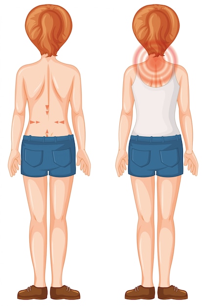 Free vector back of human female with pain spots