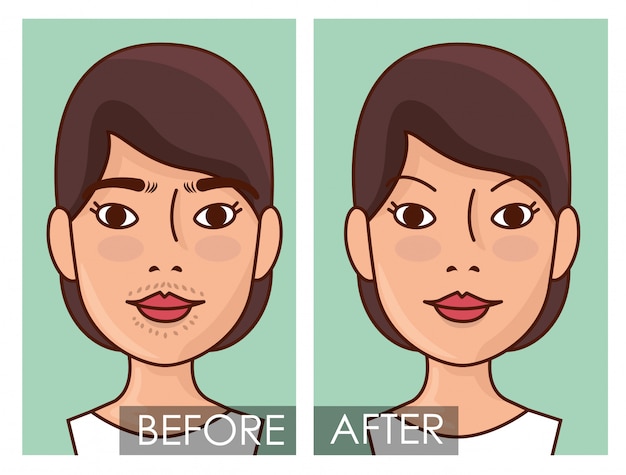 Free Vector before and after woman with hair removal treatment