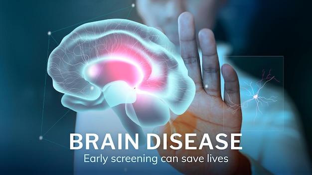 Free Vector brain disease technology template