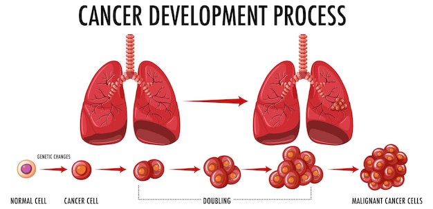 Cancer development process infographic