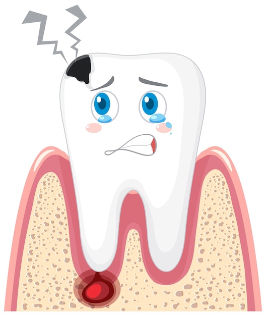 Free vector caries and inflammation in the gums on a white background