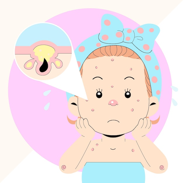 Cartoon oily skin illustration with woman