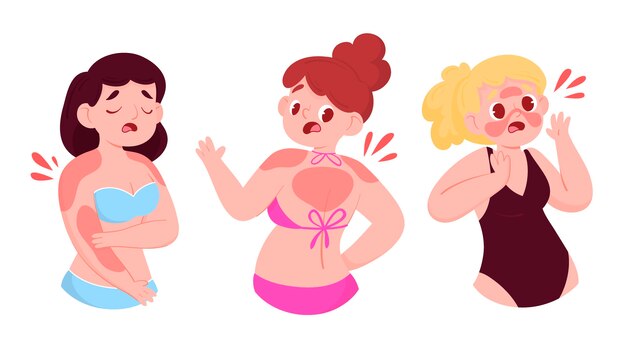 Cartoon people with a sunburn illustrated