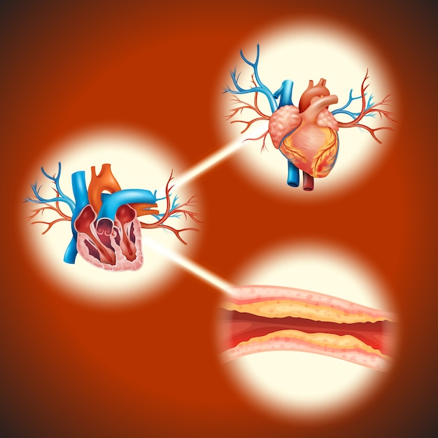 Free Vector cholesteral in human heart