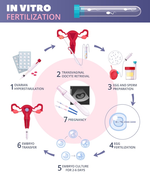 Colored flat in vitro fertilization IVF infographics with steps from ovarian hiperstimulation to pregnancy