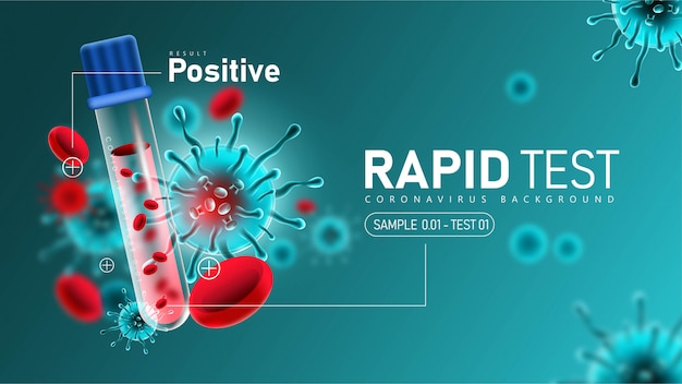 Coronavirus 2019- ncov Rapid Test with Positive Result