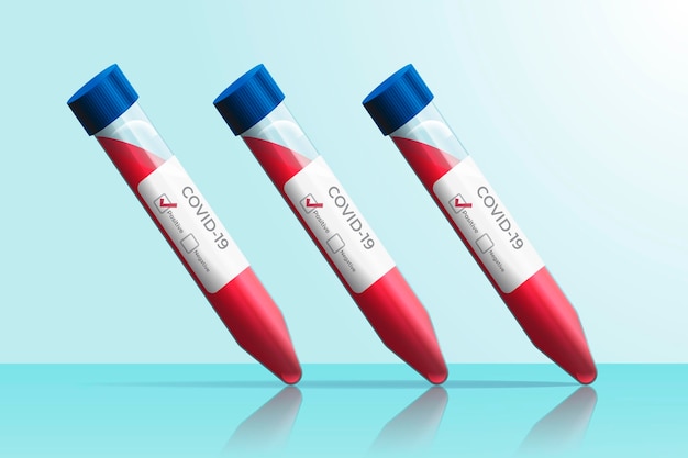 Coronavirus blood test concept