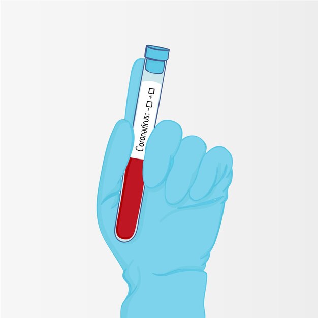 Coronavirus blood test