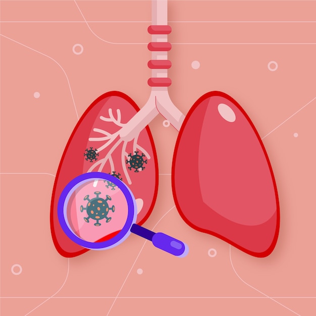 Coronavirus pneumonia concept