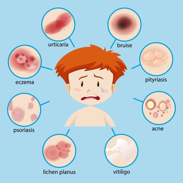 Diagram showing boy with different skin conditions