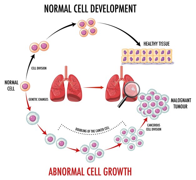 Diagram showing cancer development process