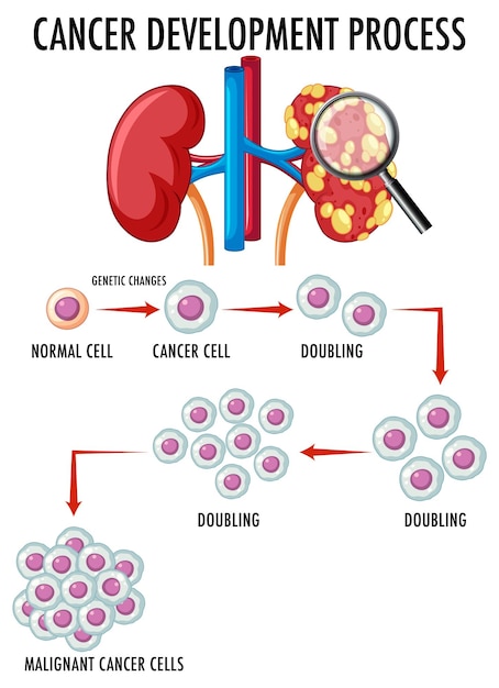 Diagram showing cancer development process