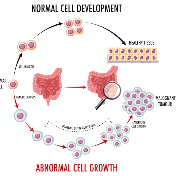 Diagram showing cancer development process