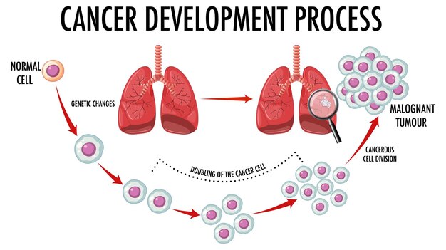 Diagram showing cancer development process