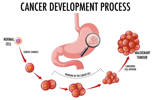 Diagram showing cancer development process