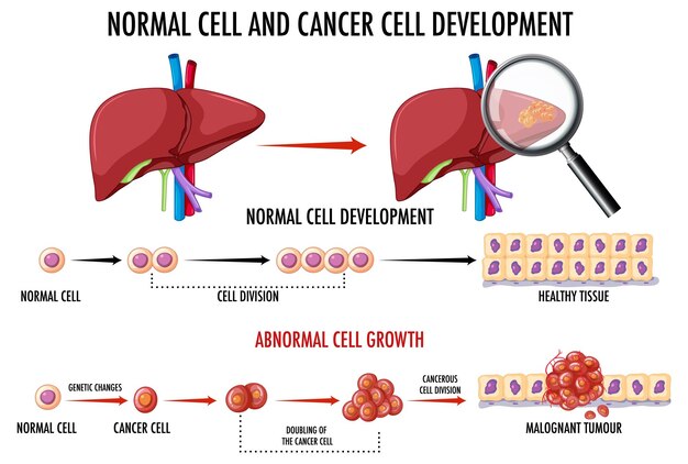 Diagram showing cancer development process