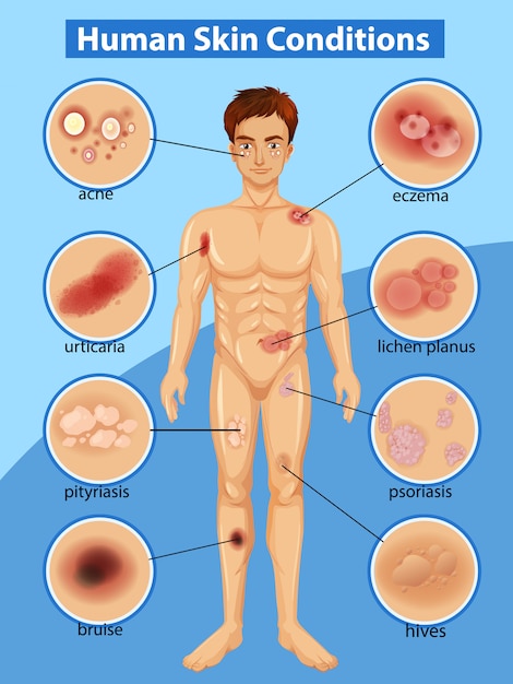 Free Vector diagram showing differen human skin conditions