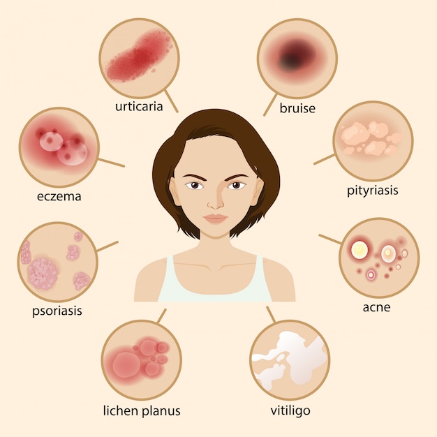 Free Vector diagram showing different sickness