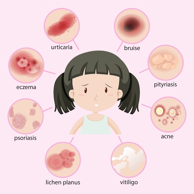 Free Vector diagram showing different types of disease in kid