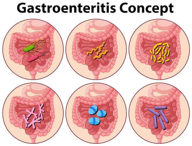 Free Vector diagram showing gastroenteritis concept illustration