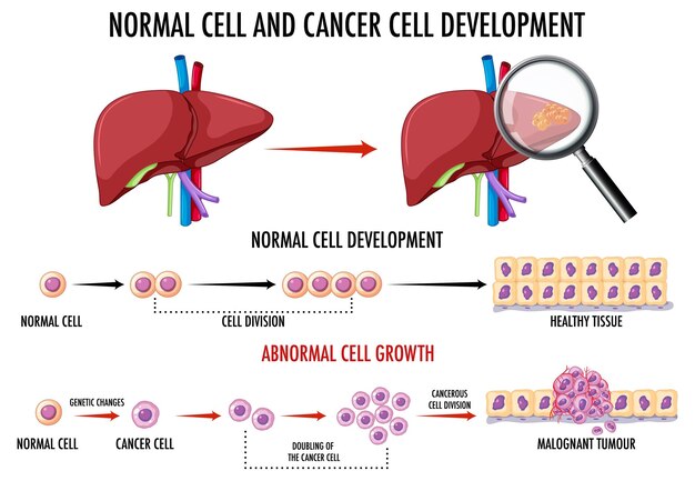 Diagram showing normal and cancer cell