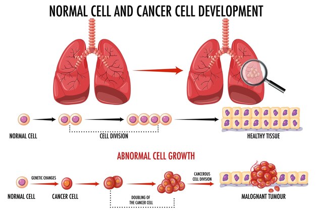 Diagram showing normal and cancer cell