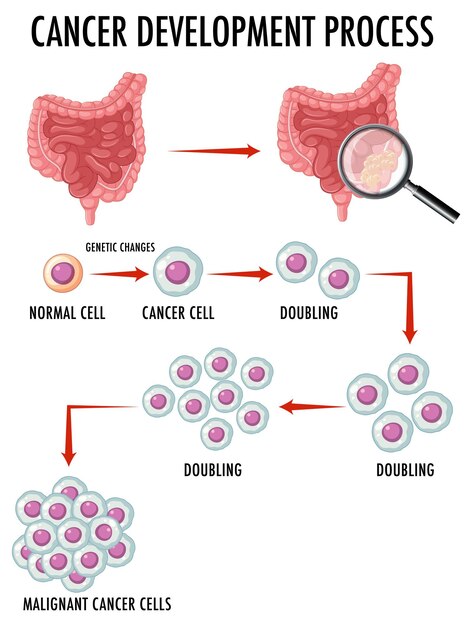 Diagram showing normal and cancer cells in human