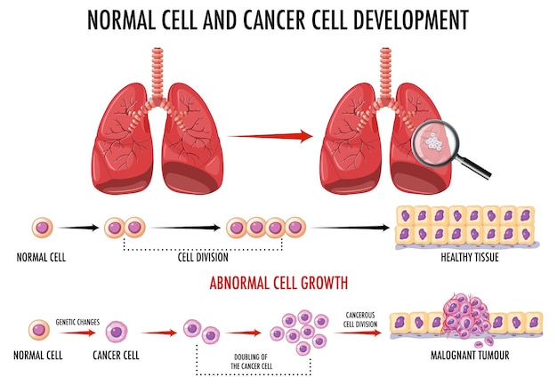 Diagram showing normal and cancer cells