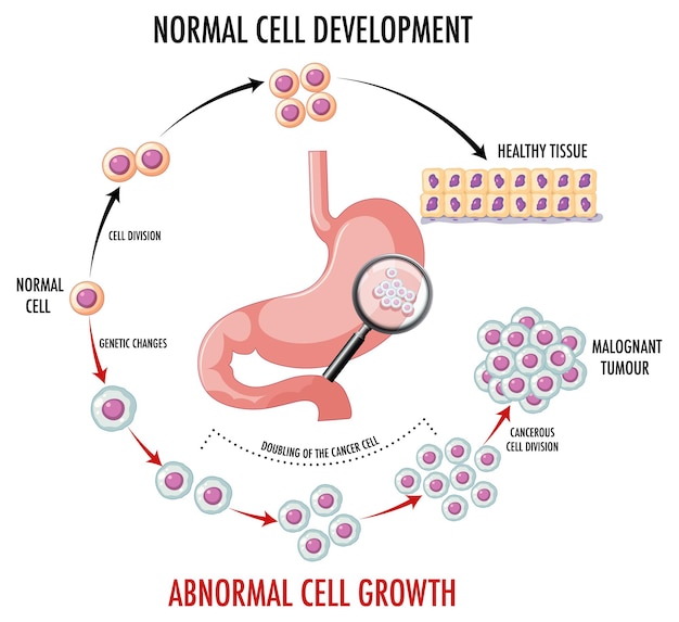 Free Vector diagram showing normal and cancer cells