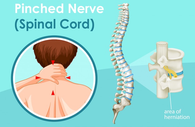 Free Vector diagram showing spinal cord