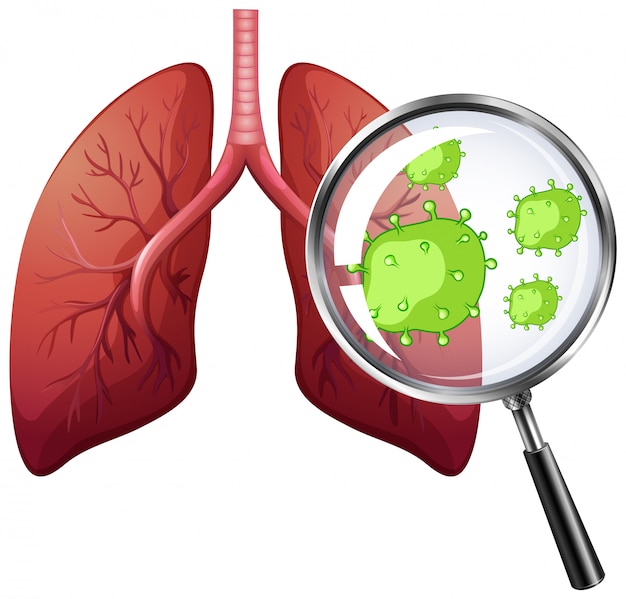 Diagram showing virus cells in human lungs