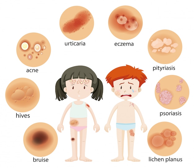 Different skin conditions on human girl and boy