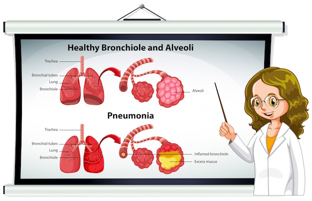 Doctor explaining healthy bronchiole and alveoli