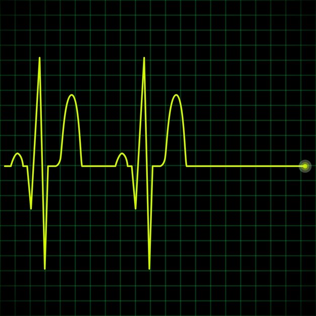 Electronic graph in yellow color