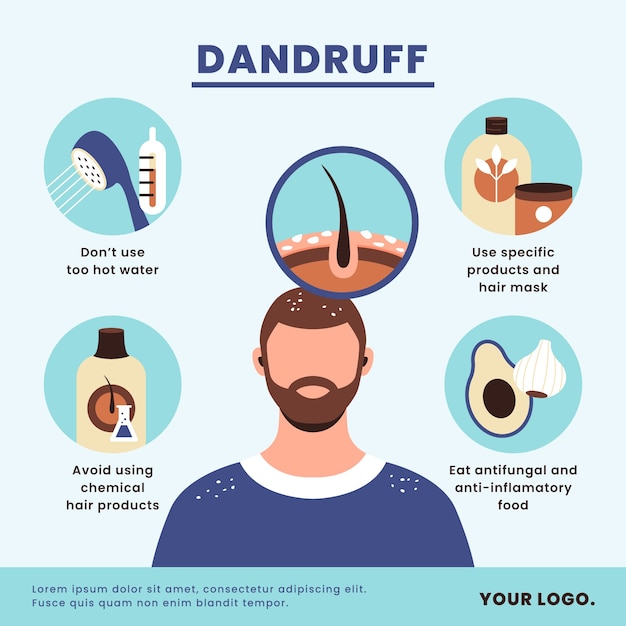 Free vector flat design dandruff infographic