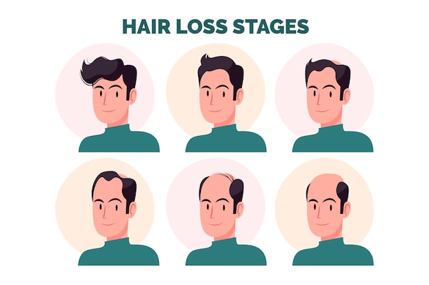 Free vector flat-hand drawn hair loss stages illustration with man