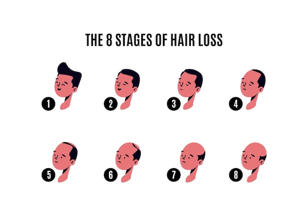 Free Vector flat-hand drawn hair loss stages illustration