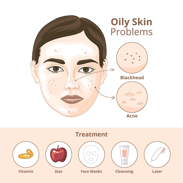 Free Vector flat-hand drawn oily skin problems infographic template