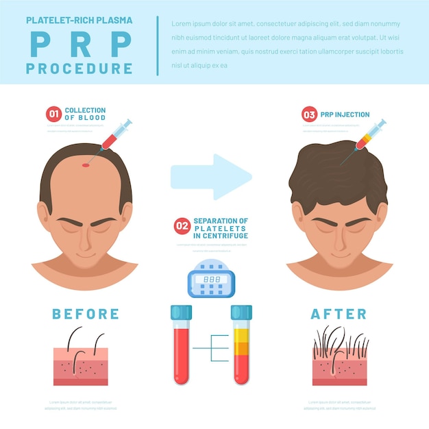 Free Vector flat-hand drawn prp procedure infographic