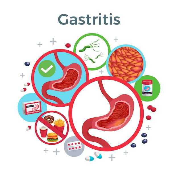 Free Vector gastritis disease symptoms causes medicine flat circular composition of healthy and affected stomach bacteria food