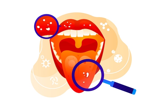 Free Vector gradient stomatitis illustration