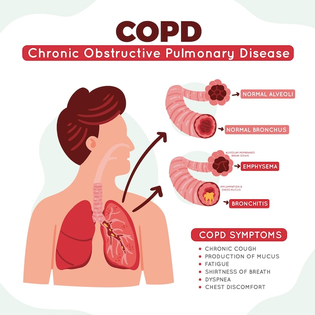 Hand drawn chronic obstructive pulmonary disease infographic