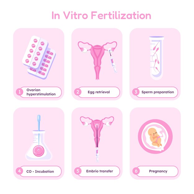 Hand drawn flat design ivf infographic